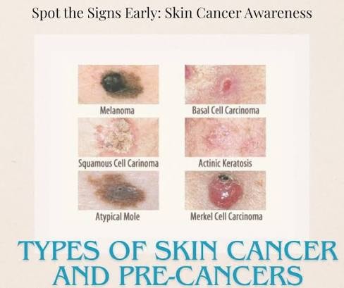Skin Condition Treatment